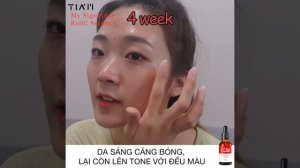 THỬ THÁCH 4 TUẦN "ĐUỔI" THÂM MỤN VÀ DƯỠNG TRẮNG THẦN KÌ VỚI REDC