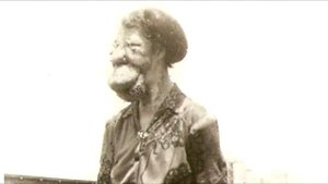 Она родилась с лошадиным лицом. Вы не поверите, вот что с ней стало!