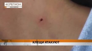 ПЕРВЫЕ НАПАДЕНИЯ КЛЕЩЕЙ ЗАРЕГИСТРИРОВАЛИ НА КАМЧАТКЕ • НОВОСТИ КАМЧАТКИ