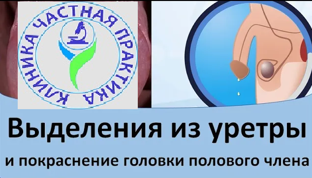 Выделения из уретры и покраснение головки полового члена