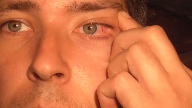 Курица клюнула в глаз смотреть онлайн