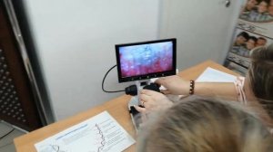 Первая капилляроскопия