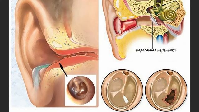 Профилактика глухоты. Как сохранить слух любителям музыки? смотреть онлайн