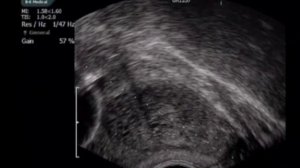 ? САМЫЕ ПЕРВЫЕ ПРИЗНАКИ РАКА