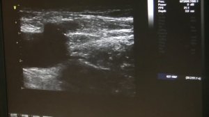 Носенко Е.М. Артерии и вены нижних конечностей. Измерение ЛПИ