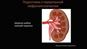 КТ Абдоминальная визуализация 16 Лекция «КТ почек и МВС» Лектор Пихута Д А 4