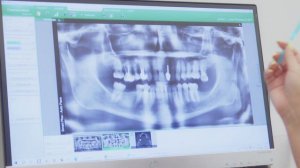 Что делать когда мало места под имплант зуба?