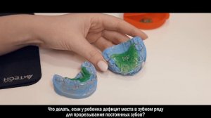 Что делать, если у ребенка дефицит места в зубном ряду для прорезывания постоянных зубов?