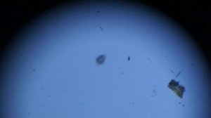 Почвенный клещ. Вода из поддона цветочного горшка