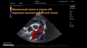 Стеноз клапана легочной артерии у собаки, эхокардиография.