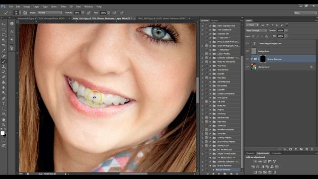 FREE Braces Remover Action for Photoshop or Elements смотреть онлайн
