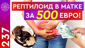 #237 Рептилоид в матке за 500 евро...