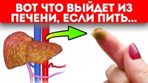 Советская чистка печени! Из печени вышла такая гадость, после того, как утром выпил...