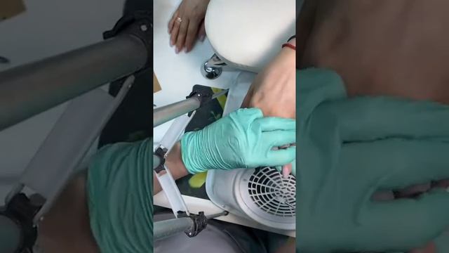 Быстрое снятие