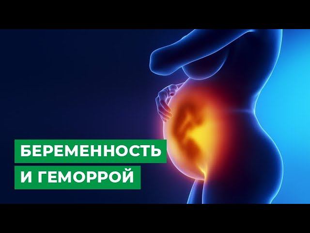 Беременность и геморрой