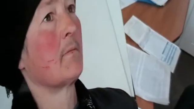 ЛИПЕНЬ 2017,ЦКУВАННЯ МАТЕРІ АТОШНИКА З СЕЛА ДІДКІВЦІ, ПІД ЧУДНОВОМ смотреть онлайн