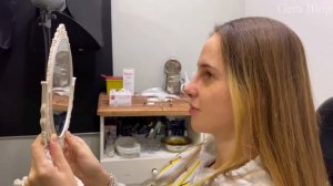 Повторная ринопластика и результат до и после. Ринопластика в Стамбуле