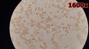 Кровь после дыхательных практик. СЕНСАЦИЯ!!!