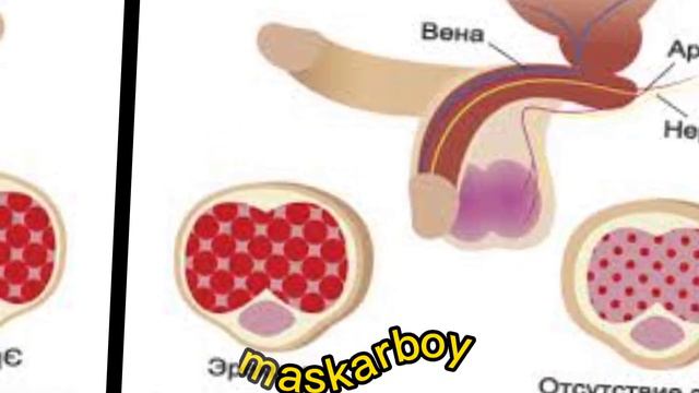 Средство для стояка. Виагра. История создания смотреть онлайн