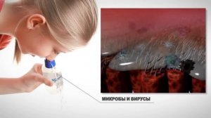 Долфин - как промывать нос ребенку ?