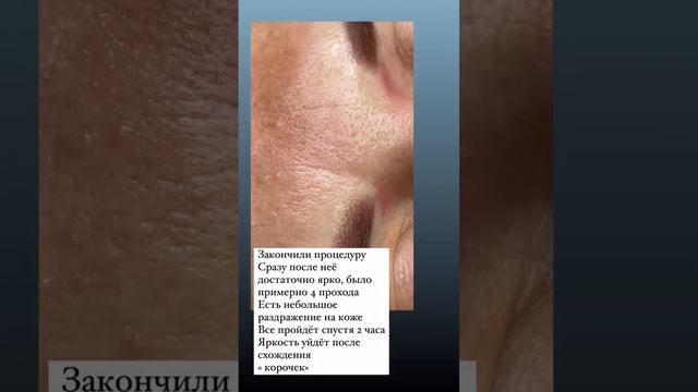 Перманент для тех кто немного постарше?#перманент #татуажбровей #калининград #брови #балтика