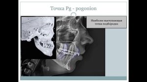 Анатомия челюстно-лицевой области и ТРГ.  Цефалометрические точки. Строение ВНЧС.