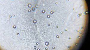 Споры маленького грибка,с пенька, под микроскопом