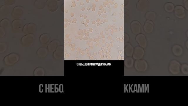 Как разжижать кровь без вреда здоровью