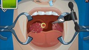 Operate Now: Tonsil Surgery - walkthrough