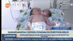 😱В Самарканде родился двухголовый ребёнок !😳