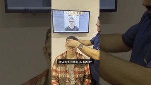 Отличный результат спустя 7 месяцев. Пересадка волос. Турция, Стамбул. Александр, Россия.