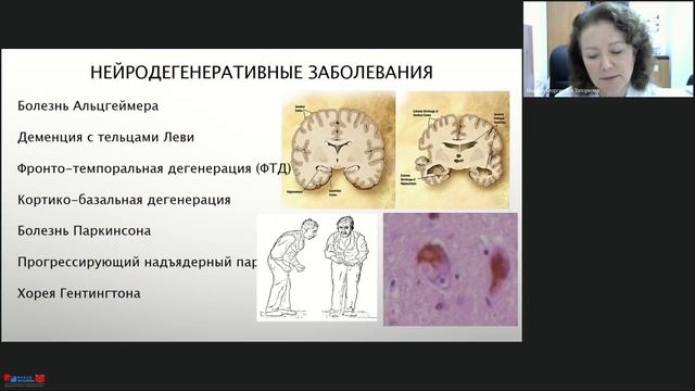 Нарушения памяти и познавательной функции- причины, диагностика, профилактика и лечение.mp4