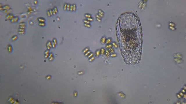 диффлюгия под микроскопом смотреть онлайн