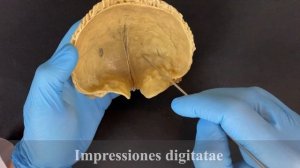 Лобная кость - Os frontale (анатомия человека)