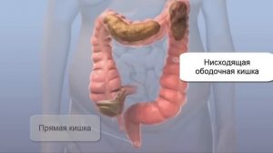 Толстая и прямая кишка Очищение кишки человека