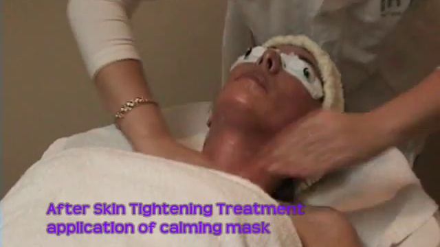 Soprano XL- Skin Tightening Treatment смотреть онлайн