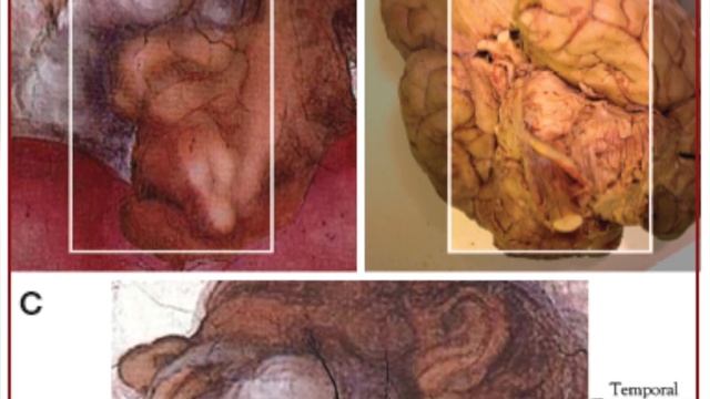 Тайны Сикстинской капеллы. Что скрывает Микеланджело?