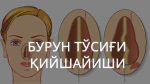 Болаларда тез тез бурун битиши давоси