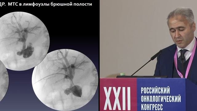 Операции