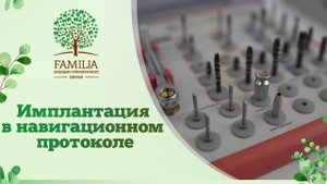 ↪ Имплантация в навигационном протоколе