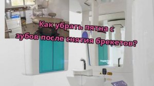Как убрать пятна с зубов после снятия брекетов?