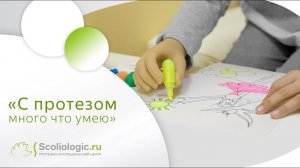 С бионическим протезом… много что умею