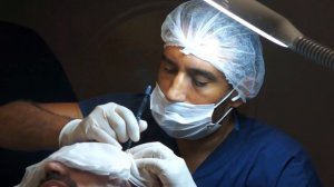 My Experience with Istanbul Vita from Albania | Hair Transplant in Istanbul / Turkey