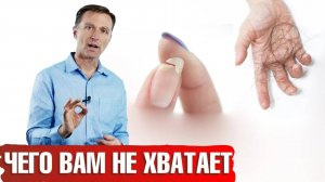 Почему выпадают волосы, ломаются ногти и сухая кожа? | Каких витаминов не хватает?📣