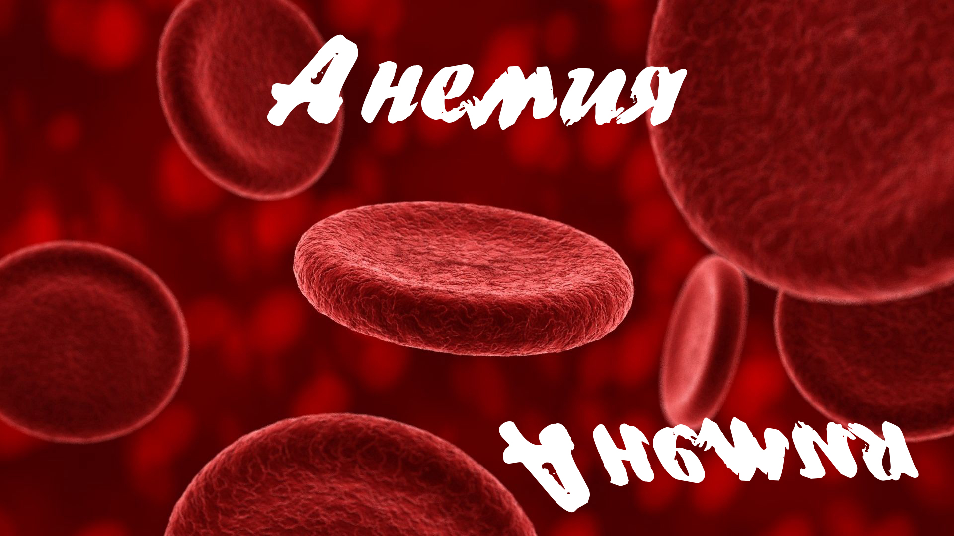 Анемия