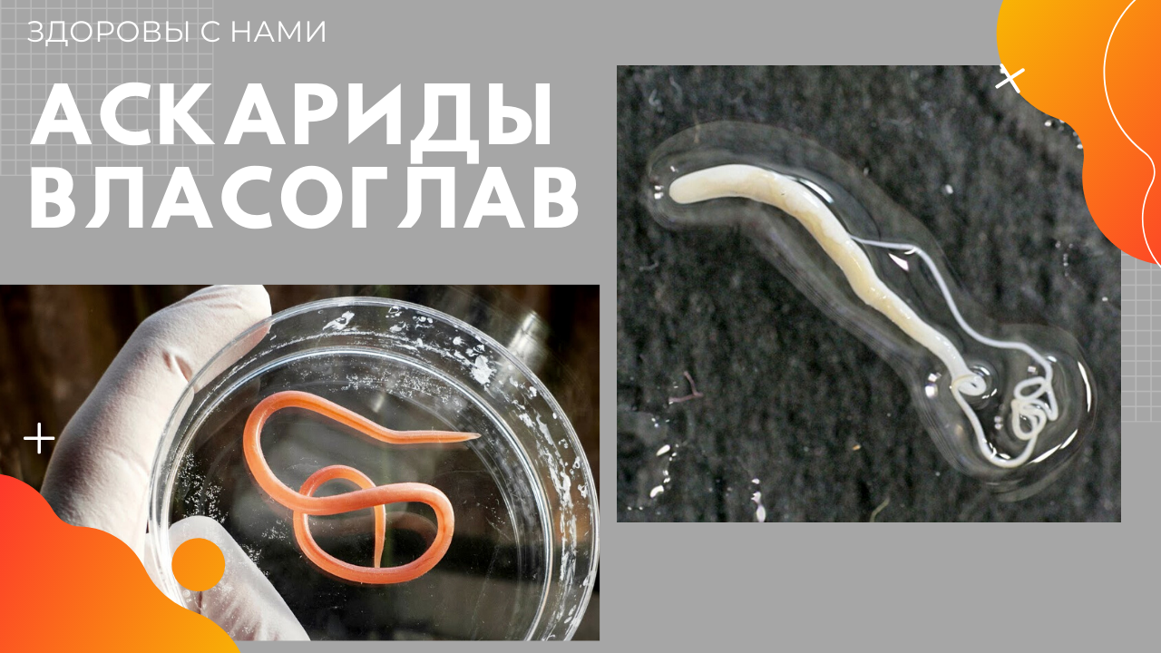 Прямой эфир 15.05 Дети и паразиты.mp4 смотреть онлайн