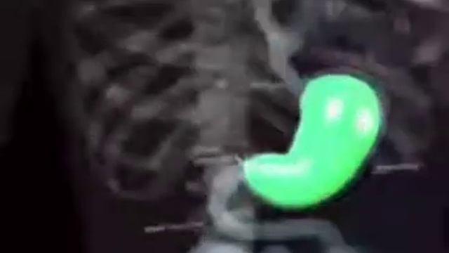 я в туалете когда поел в школьной столовой смотреть онлайн