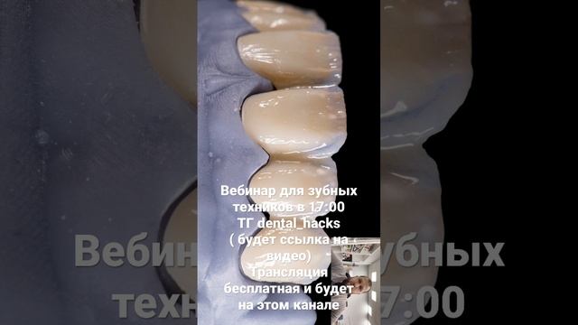 Вебинар для зубных  техников #зубнойтехникмосква #циркон #3дмодель #cadcam #exocad #dentacad #ceram