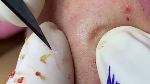 Satisfying Relaxing Best Video with Win Spa #128