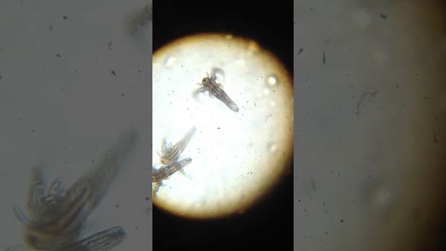 Бактерии под микроскопом 1 смотреть онлайн